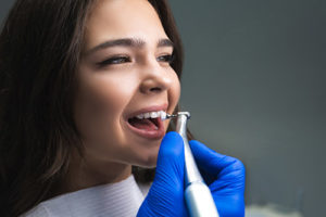 woman with open mouth having her teeth cleaned, teeth cleaning pasadena tx