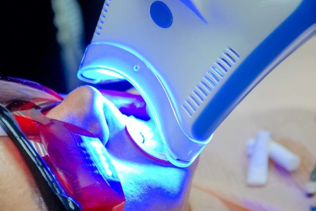 a patient undergoing treatment for removing stains