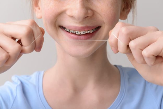 a young woman trying to floss with braces