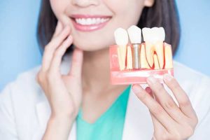 a doctor poses with sample dental implants