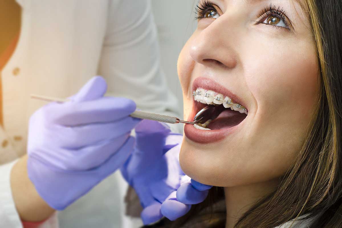 Benefits of Adult Orthodontic Services Orthodontics Pasadena TX